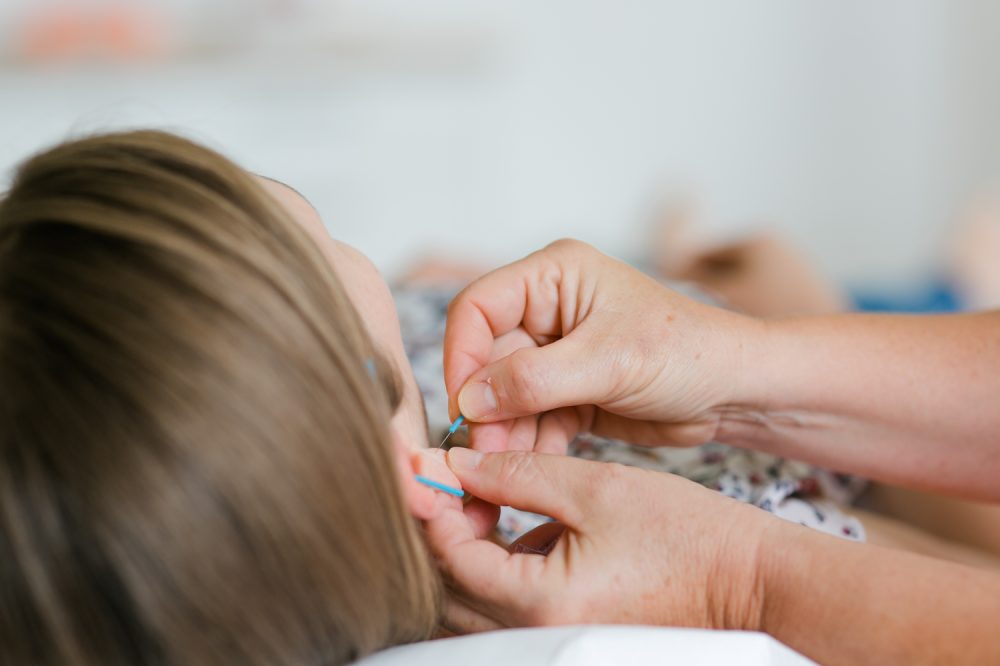 Akupunktur am Ohr bei einer Heilpraktikerin